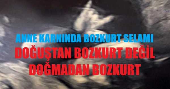 Doğuştan BOZKURT Değil Doğmadan BOZKURT